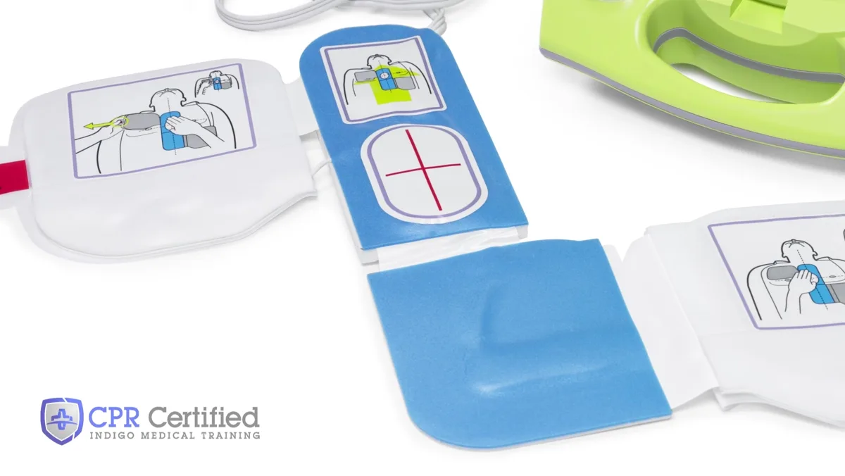 Two AED pads laid out with their diagrams facing up, showing where each one goes on the body.